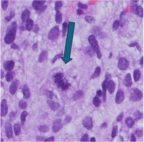 顕微鏡で見たGIST細胞