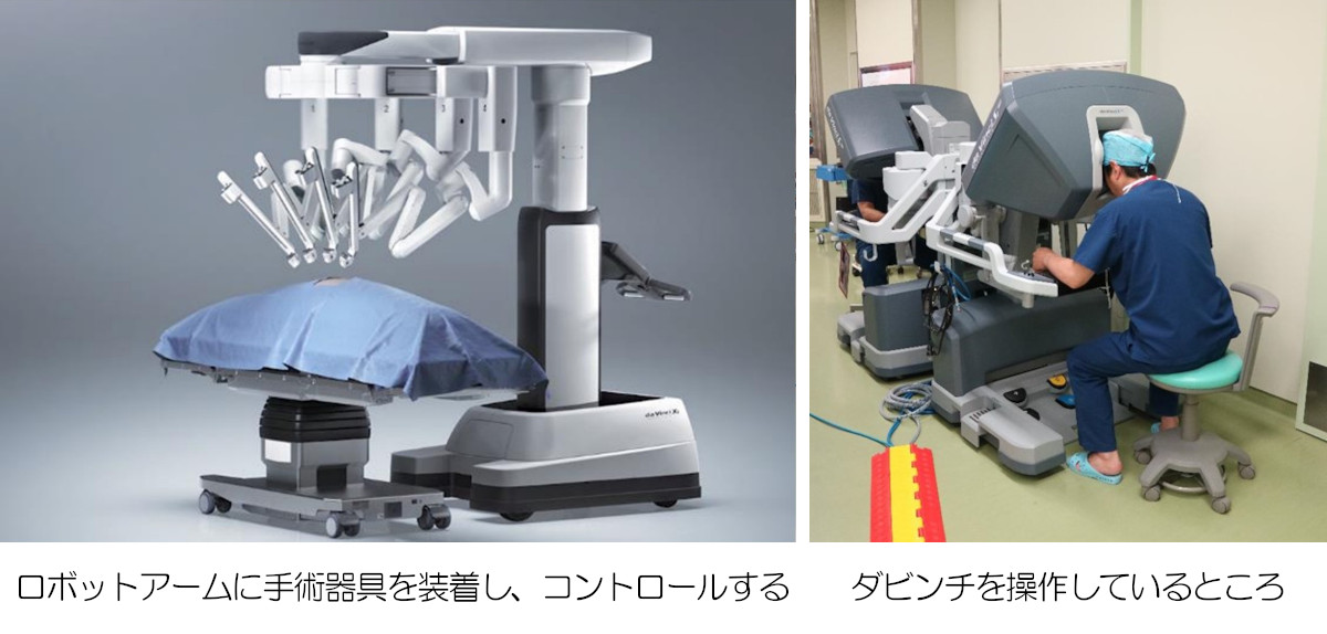 手術支援ロボット（ダヴィンチ）