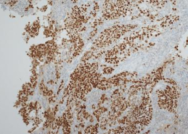 免疫染色した病理組織像